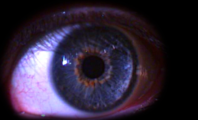 My eye!